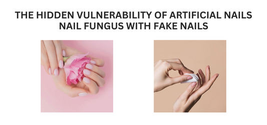 The Hidden Vulnerability of Artificial Nails: Nail Fungus with Fake Nails